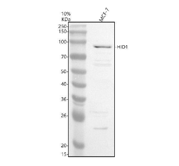 Western blot analysis of C17orf28/HID1 using anti-C17orf28/HID1 antibody (A08622)