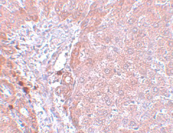 a08623 1 ndufb9 primary antibodies ihc testing 2