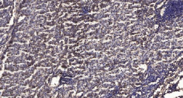 a08623 ndufb9 primary antibodies ihc testing 1