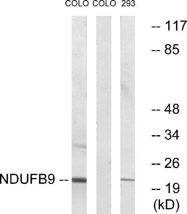 a08623 ndufb9 primary antibodies wb testing 2