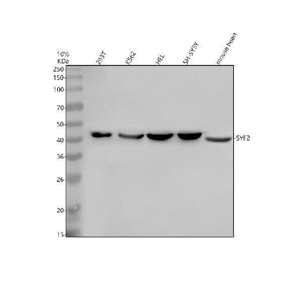 Western blot analysis of SYF2 using anti-SYF2 antibody (A08626-2)