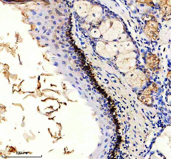 a08629 2 ppfibp1 primary antibodies ihc testing 1