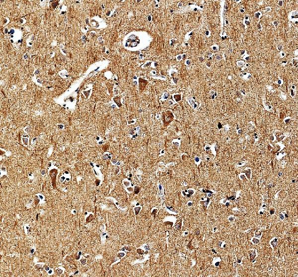 a08629 2 ppfibp1 primary antibodies ihc testing 2