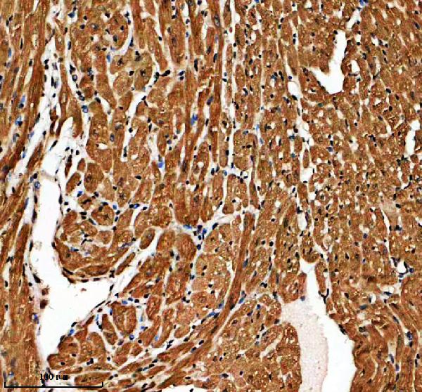 a08629 2 ppfibp1 primary antibodies ihc testing 3