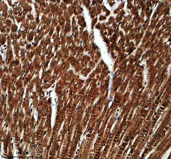 a08629 2 ppfibp1 primary antibodies ihc testing 4