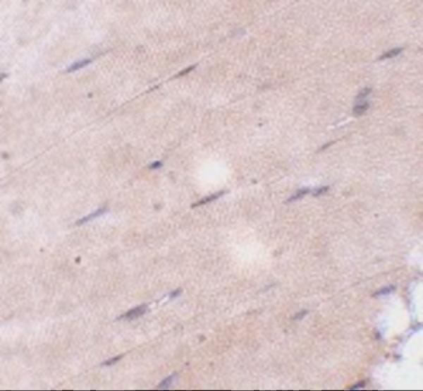 Immunohistochemistry of FNIP2 in mouse skeletal muscle tissue with FNIP2 antibody at 5 μg/mL