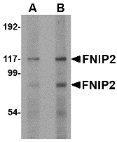 Western blot analysis of FNIP2 in rat skeletal muscle lysate with FNIP2 antibody at (A) 1 and (B) 2 μg/mL