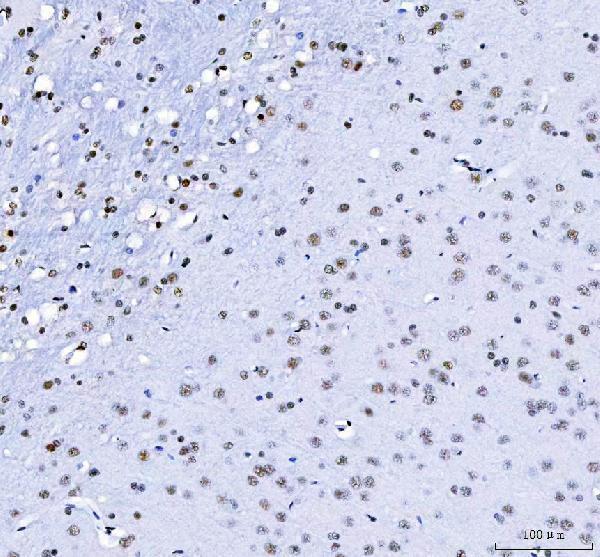a08633 3 luc7l3 primary antibodies ihc testing 11