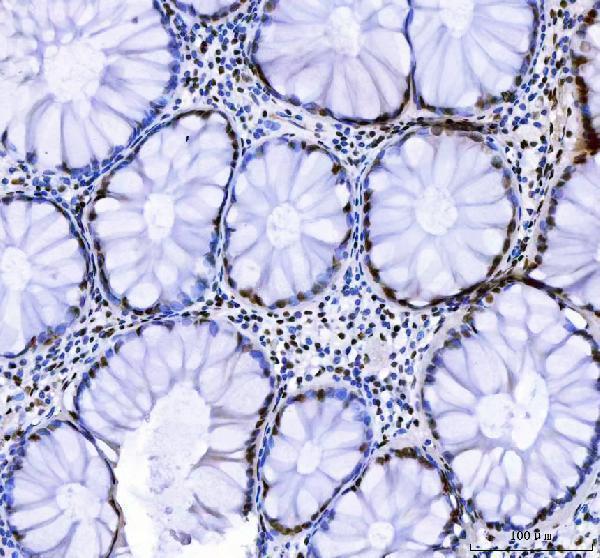  IHC analysis of CROP/LUC7L3 using anti-CROP/LUC7L3 antibody (A08633-3)