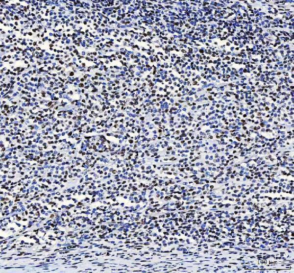  IHC analysis of CROP/LUC7L3 using anti-CROP/LUC7L3 antibody (A08633-3)