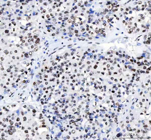 a08633 3 luc7l3 primary antibodies ihc testing 4