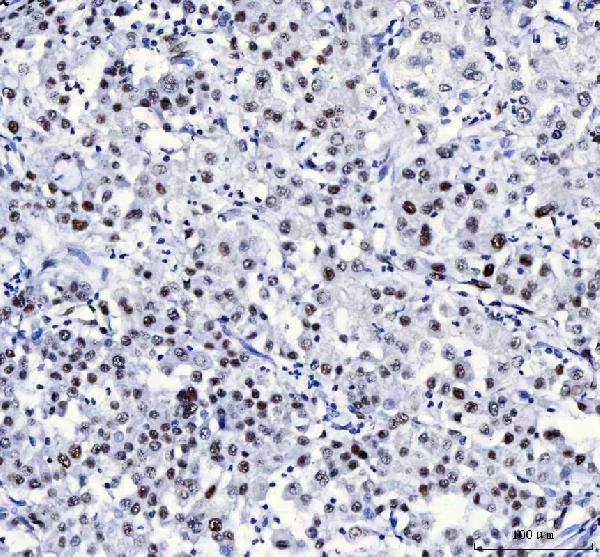 a08633 3 luc7l3 primary antibodies ihc testing 5