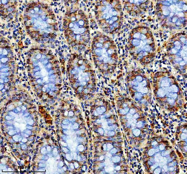 IHC analysis of HMCN1 using anti-HMCN1 antibody (A08635)