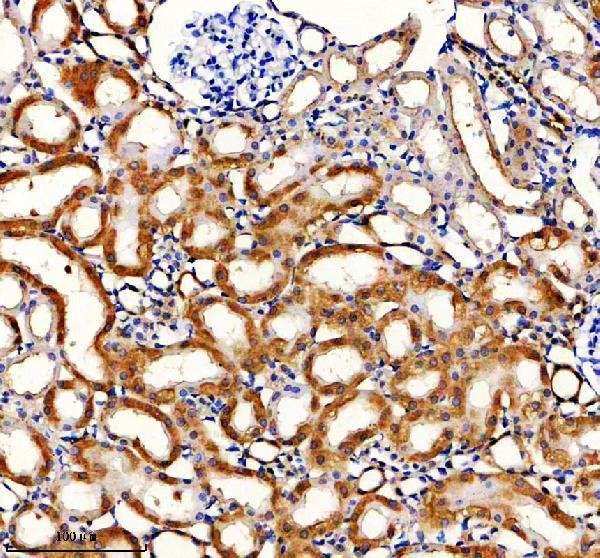 a08635 hmcn1 primary antibodies ihc testing 3