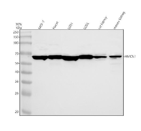 Western blot analysis of HMCN1 using anti-HMCN1 antibody (A08635)