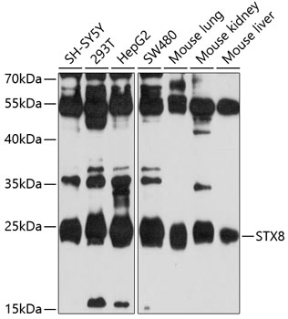 Western blot analysis of extracts of various cell lines, using STX8 antibody  at 1:1000 dilution