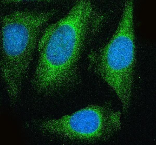 a08638 2 ndufb11 primary antibodies if testing 1