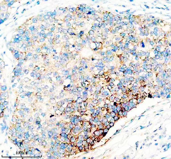 IHC analysis of NDUFB11 using anti-NDUFB11 antibody (A08638-2)