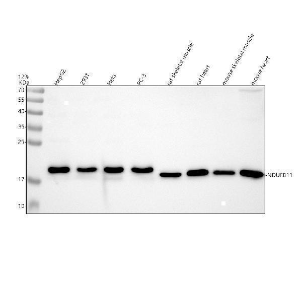 Western blot analysis of NDUFB11 using anti-NDUFB11 antibody (A08638-2)