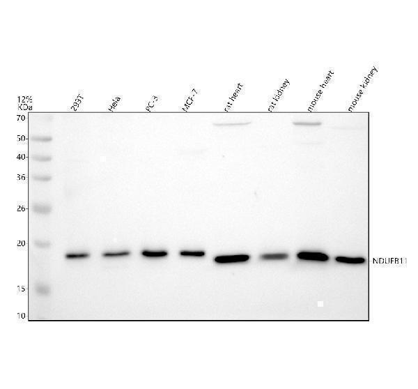 Western blot analysis of NDUFB11 using anti-NDUFB11 antibody (A08638-2)