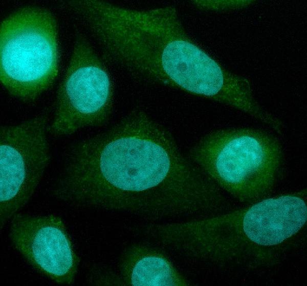 a08642 d2hgdh primary antibodies if testing 1
