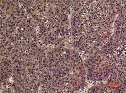 a08643 il36b primary antibodyes ihc testing 1
