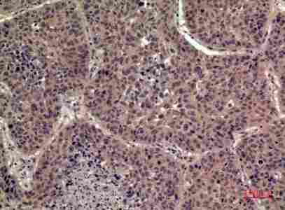 a08643 il36b primary antibodyes ihc testing 3