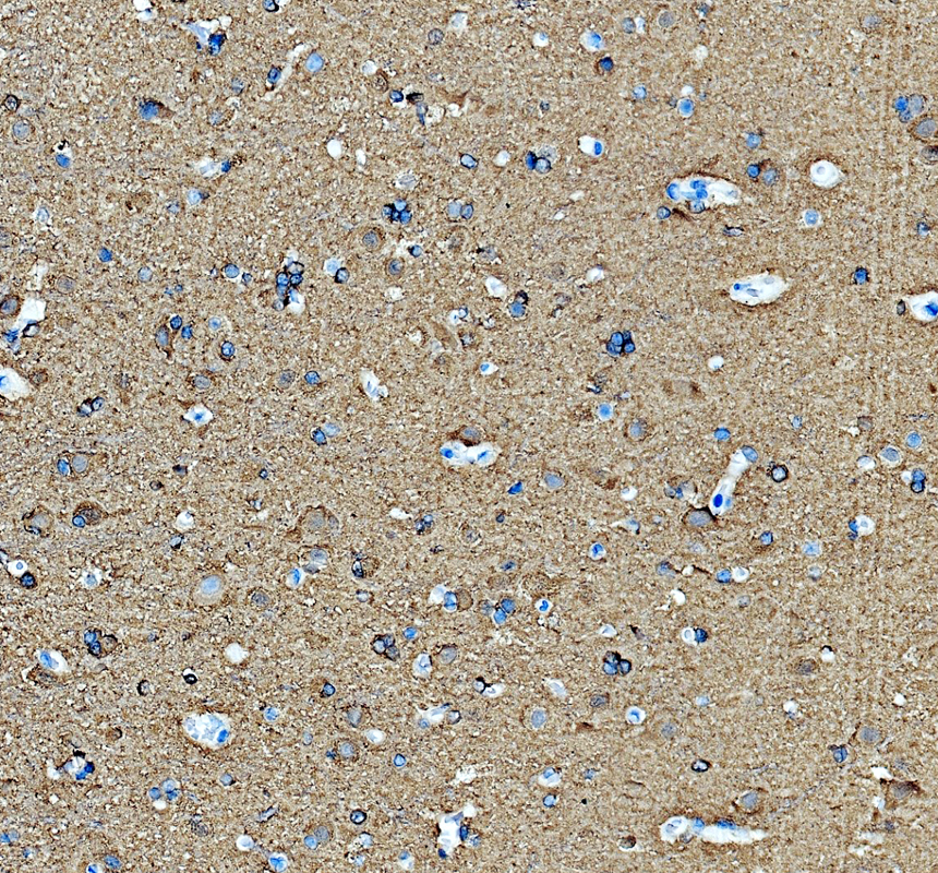IHC analysis of DPYSL5 using anti-DPYSL5 antibody (A08644-1)