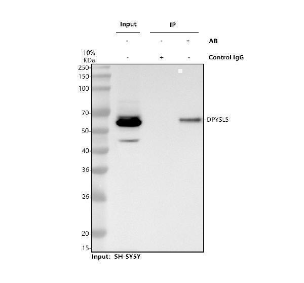 Immunoprecipitating DPYSL5 in SH-SY5Y whole cell lysate