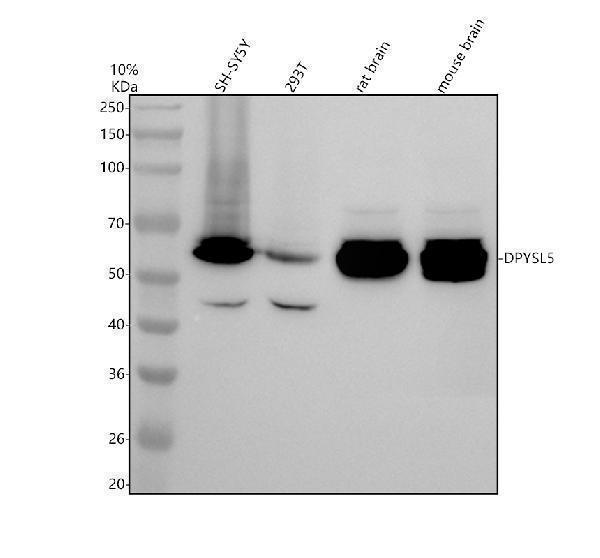 Western blot analysis of DPYSL5 using anti-DPYSL5 antibody (A08644-1)