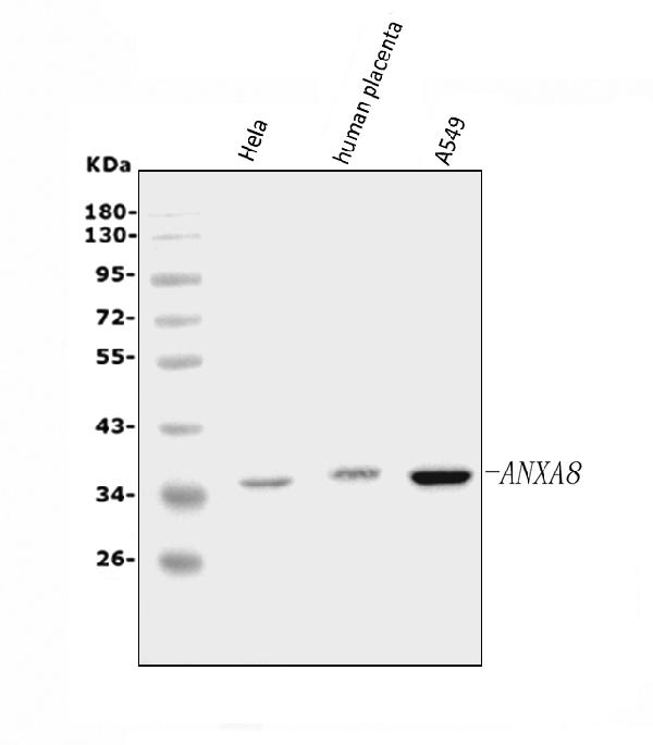 Western blot analysis of Annexin VIII using anti-Annexin VIII antibody (A08645).