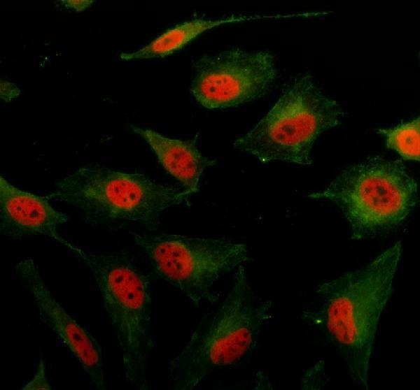 a08646 3 hmg20b primary antibodies if testing 1