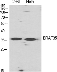 Western Blot (WB) analysis of specific cells using BRAF35 Polyclonal antibody