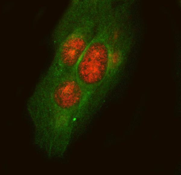 a08649 pla2g15 primary antibodies if testing 2