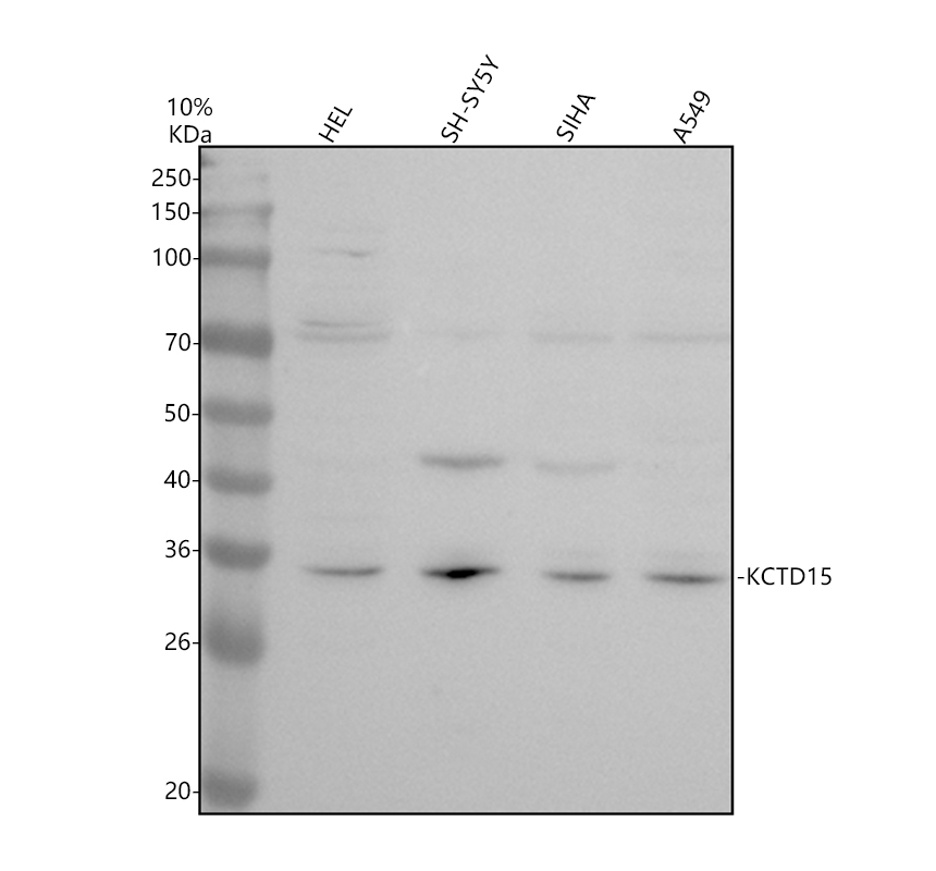 a08651 1 kctd15 primary antibodies wb testing 1