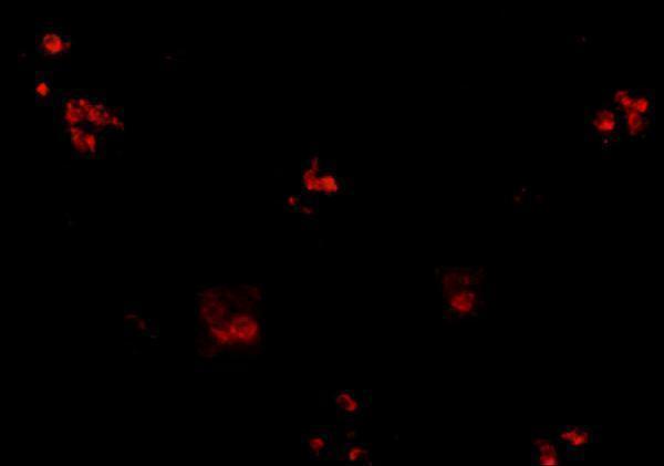 Immunofluorescence of KCTD15 in human spleen tissue with KCTD15 antibody at 20 μg/mL