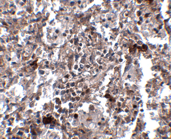 Immunohistochemistry of KCTD15 in human spleen tissue with KCTD15 antibody at 2