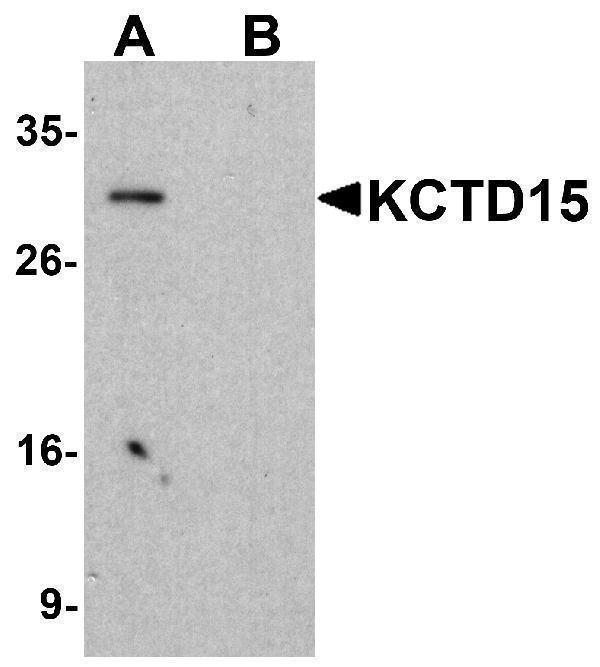 Western blot analysis of KCTD15 in HeLa cell lysate with KCTD15 antibody at 1μg/ml in (A) the absence and (B) the presence of blocking buffer