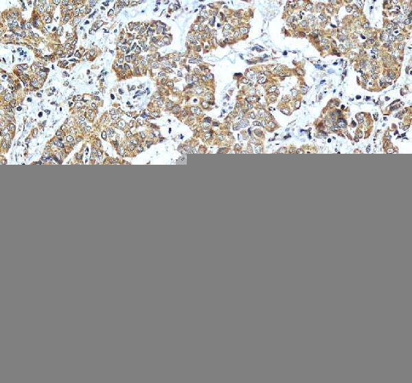 a08652 1 acadsb primary antibodies ihc testing 1