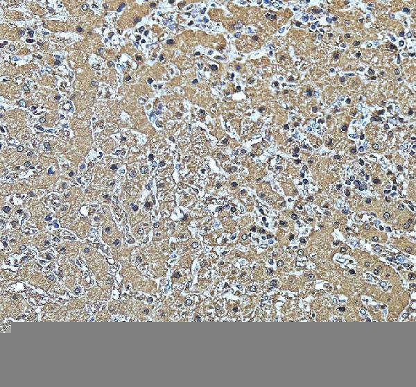 a08652 1 acadsb primary antibodies ihc testing 2