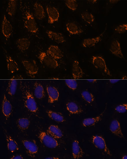 a08656 tsfm primary antiboties if testing 2
