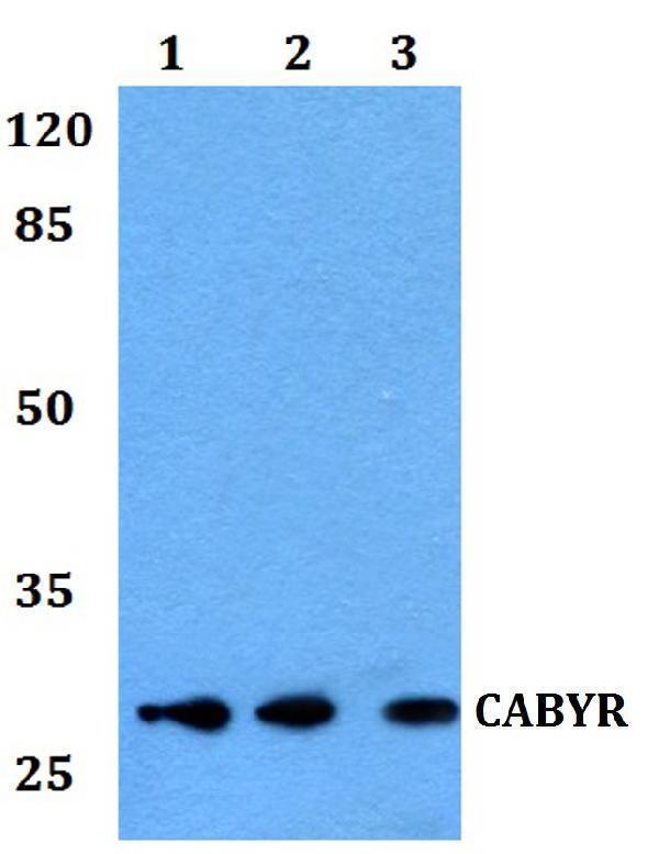 Western blot (WB) analysis of CABYR polyclonal antibody at 1:500 dilution
Lane1:Hela whole cell lysate
Lane2:sp2/0 whole cell lysate
Lane3:PC12 whole cell lysate