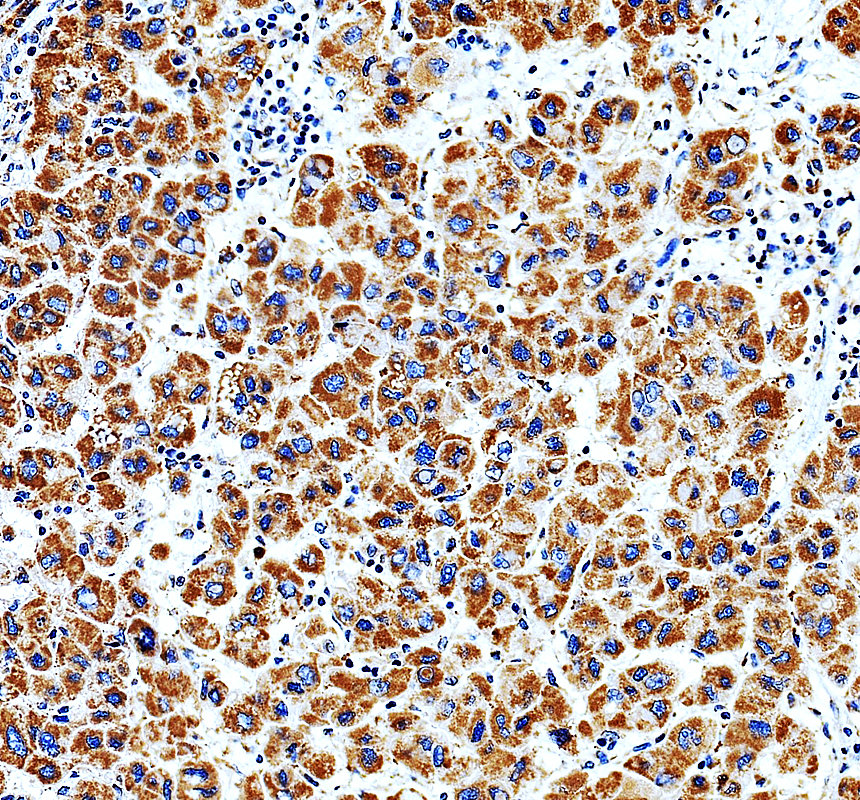 a08660 1 hibch primary antibodies ihc testing 1