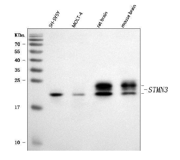  Western blot analysis of STMN3 using anti-STMN3 antibody (A08661-2)