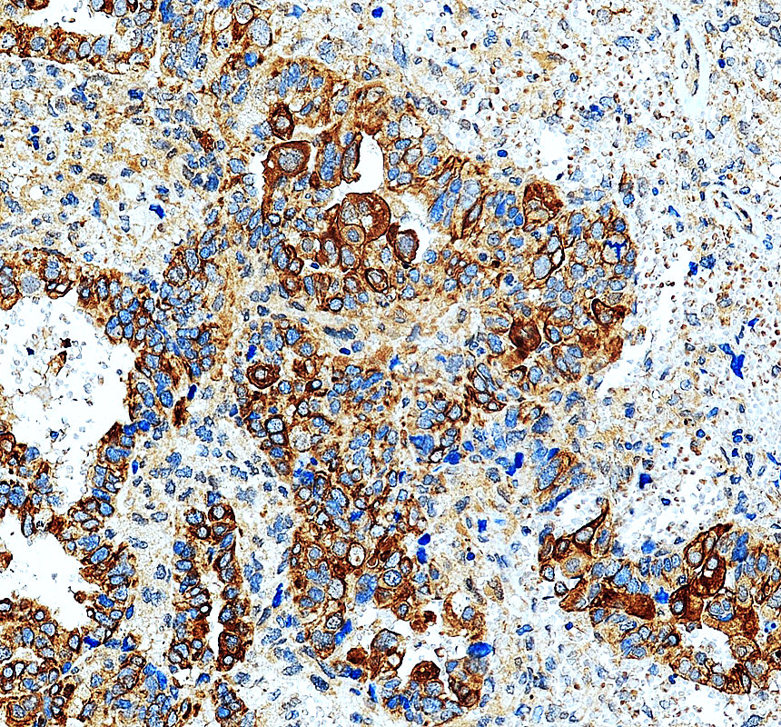 IHC analysis of GMPPB using anti-GMPPB antibody (A08665)