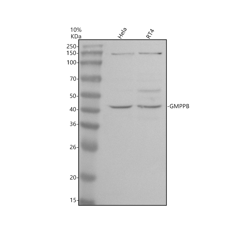 Western blot analysis of GMPPB using anti-GMPPB antibody (A08665)
