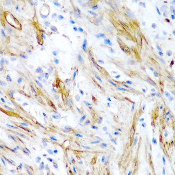 a08666 lmod1 primary antiboties ihc testing 1