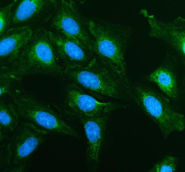 a08668 1 tom22 tomm22 primary antibodies if testing 1