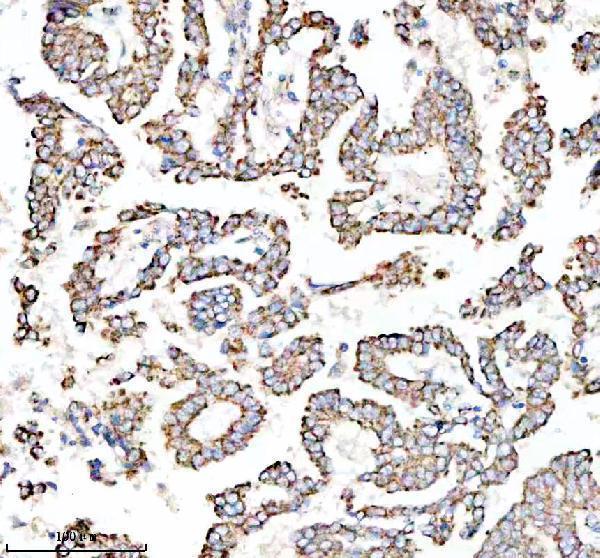  IHC analysis of TOM22/TOMM22 using anti-TOM22/TOMM22 antibody (A08668-1)