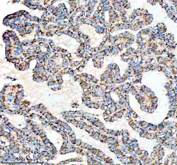  IHC analysis of TOM22/TOMM22 using anti-TOM22/TOMM22 antibody (A08668-1)